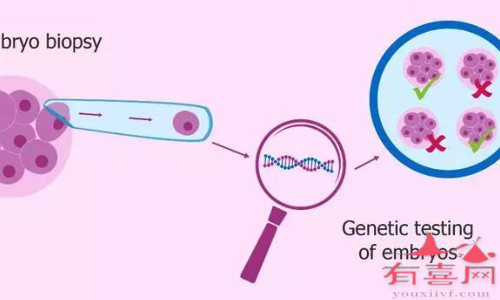 二代试管婴儿流程：三倍体的69XXY胚胎是否难以怀孕，是否必须在体外进行？(图2)